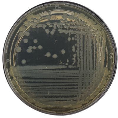 Biossurfactante